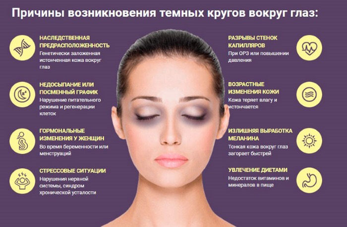 Отёки под глазами: почему они появляются и как с ними бороться?