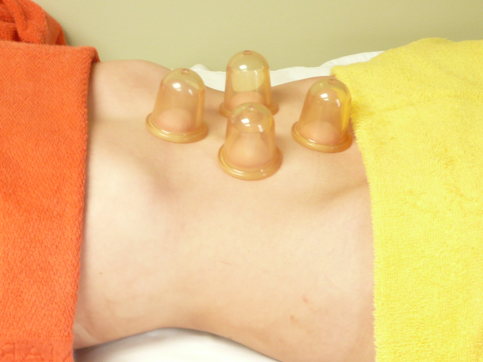 Баночный массаж