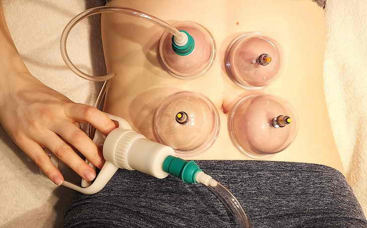 Вакуумный массаж