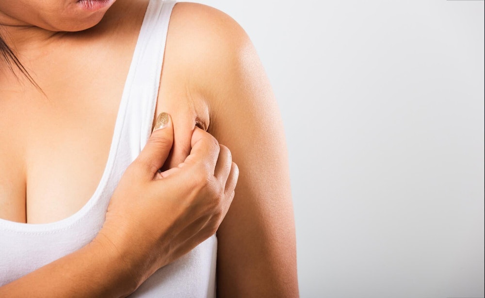 No armpit fat