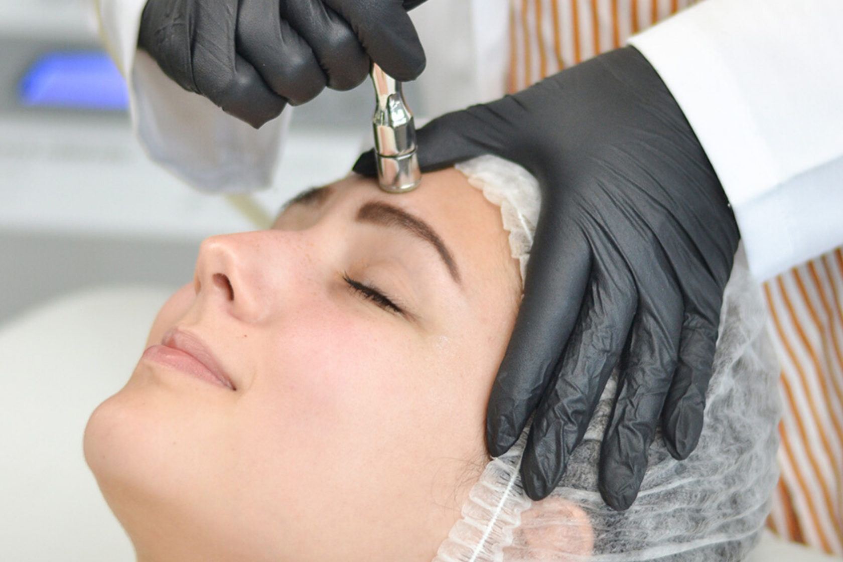 Microdermabrasion